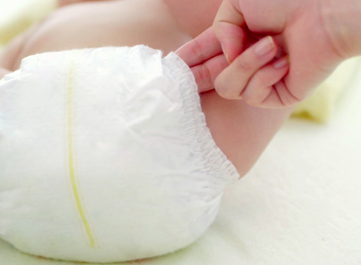 Khe hở g&acirc;y tr&agrave;n