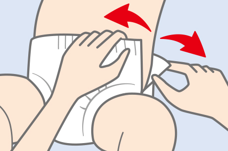 C&aacute;ch th&aacute;o t&atilde; quần Moony - X&eacute; t&atilde; dọc theo đường may b&ecirc;n h&ocirc;ng