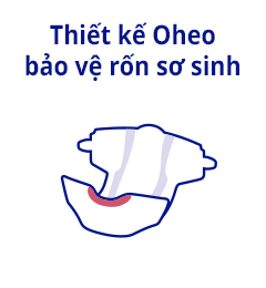 Thiết kế Oheo bảo vệ rốn sơ sinh